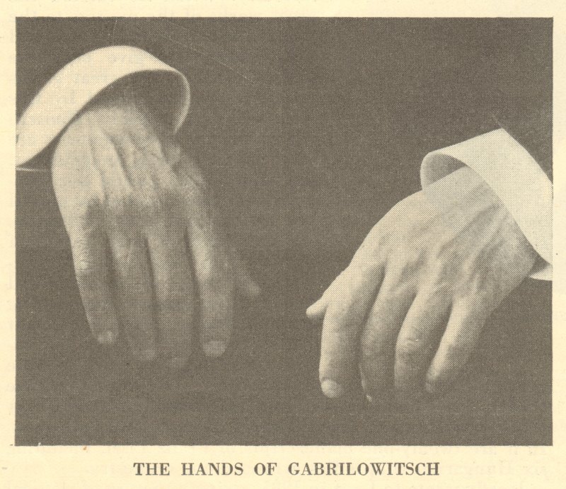http://scriabin.com/etude/1936/11/HANDS_OF_GABRILOWITSCH_001.jpg